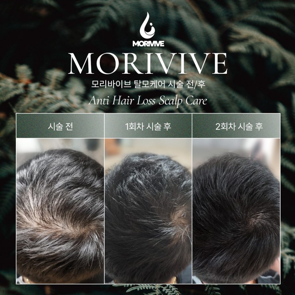 Hair Loss Care MORIVIVE