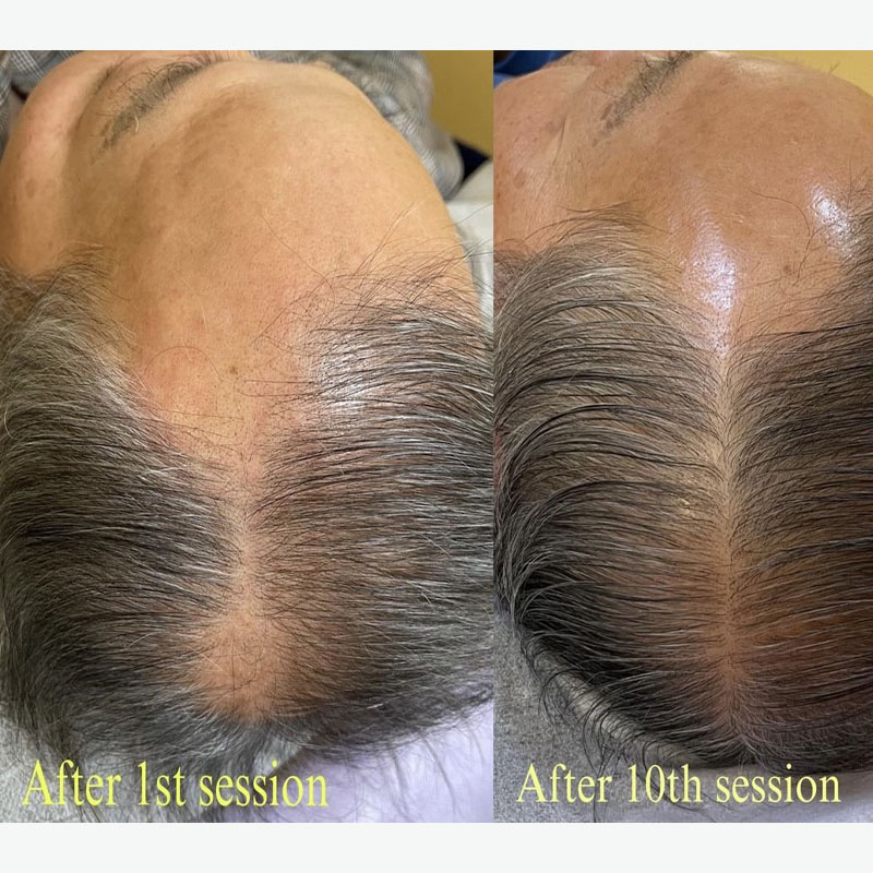 Premium Hair Loss Care Morivive