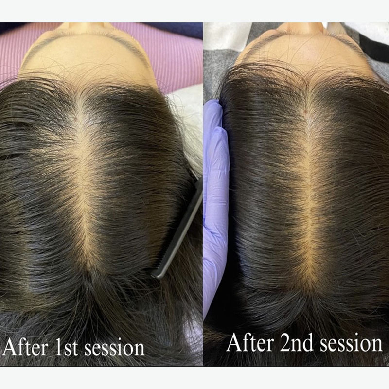 Premium Hair Loss Care Morivive