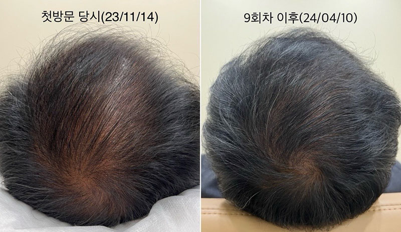 Permanent Makeup in Bellevue | Microblading Kirkland, Eyebrows Bellevue, Lash Lift Bellevue, Bellevue Microblading, Permanent makeup bellevue, male microblading cost, microblading bellevue, Eyebrow microblading for men, microblading men