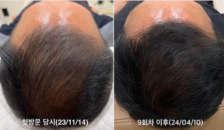 Permanent Makeup in Bellevue | Microblading Kirkland, Eyebrows Bellevue, Lash Lift Bellevue, Bellevue Microblading, Permanent makeup bellevue, male microblading cost, microblading bellevue, Eyebrow microblading for men, microblading men