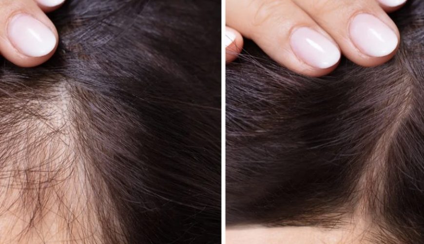 Hair Loss No More! Stop stressing and call us now!